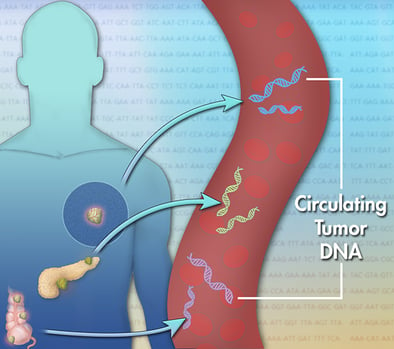 circulatory tumor