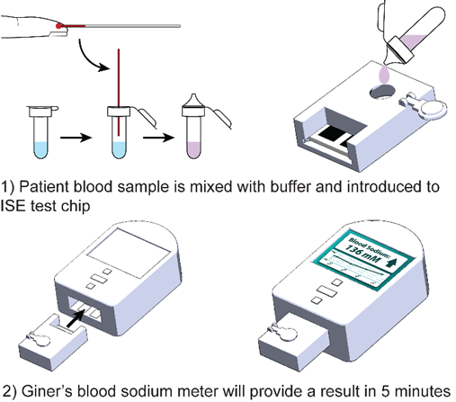 Patient blood sample introduced to ISE test chip. Giner's blood sodium meter provides result in 5 minutes.